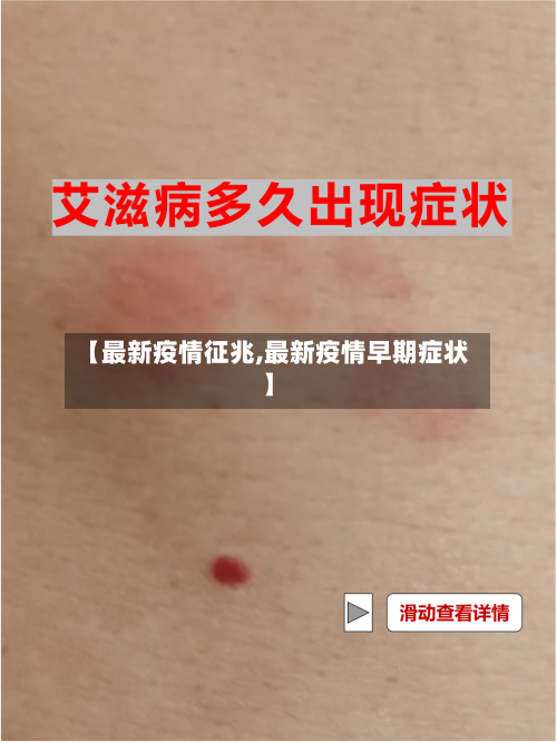 【最新疫情征兆,最新疫情早期症状】-第3张图片