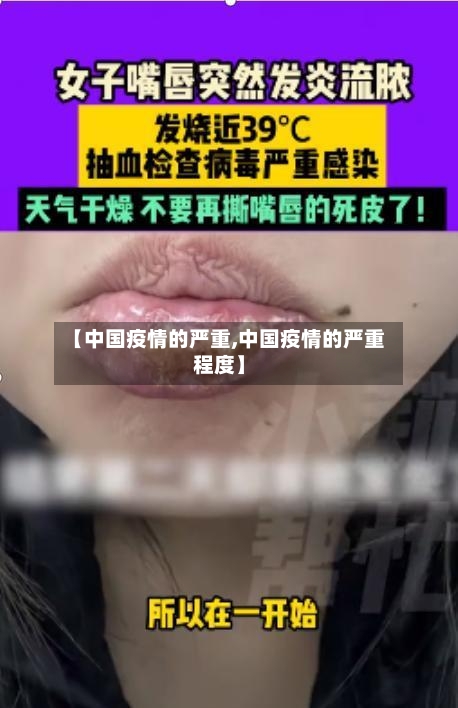 【中国疫情的严重,中国疫情的严重程度】